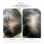 Warna Scalp Treatment Warna Haircare Dandruff Treatment